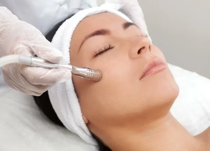 Peeling Dermoabrasão