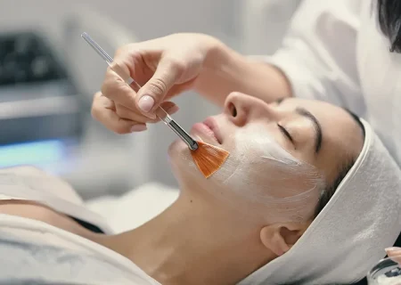Peeling químico~1