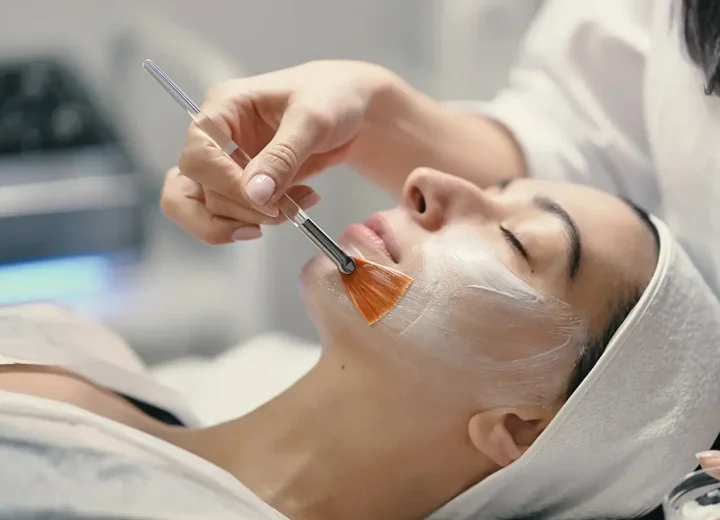 Peeling químico~1